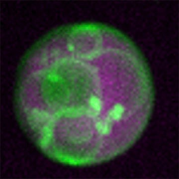 Vesicles inside a peroxisome
