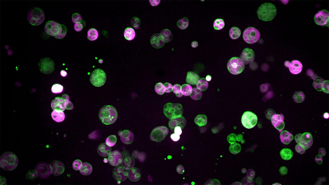 Fluorescence microscopy image of peroxisomes