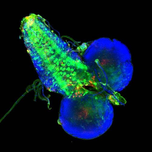Microscope image of Tau protein spread in Drosophila